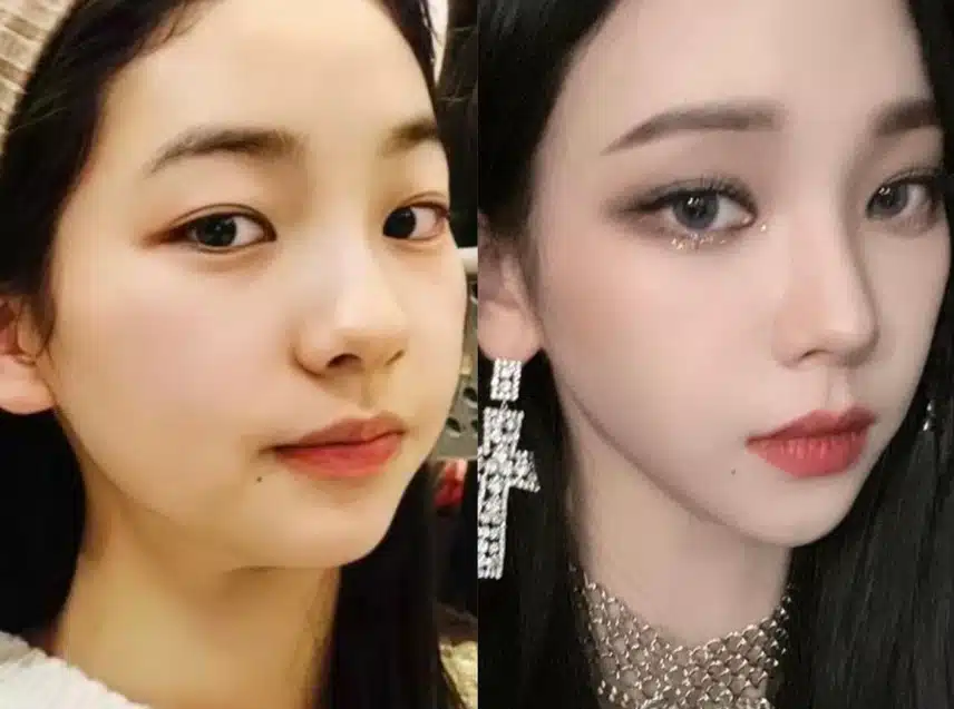 [2025最新] 卡琳娜真的整容了吗？彻底对比她小时候的照片和整容前后的形象！