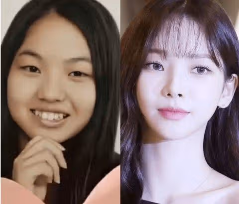 [2025最新] 卡琳娜真的整容了吗？彻底对比她小时候的照片和整容前后的形象！
