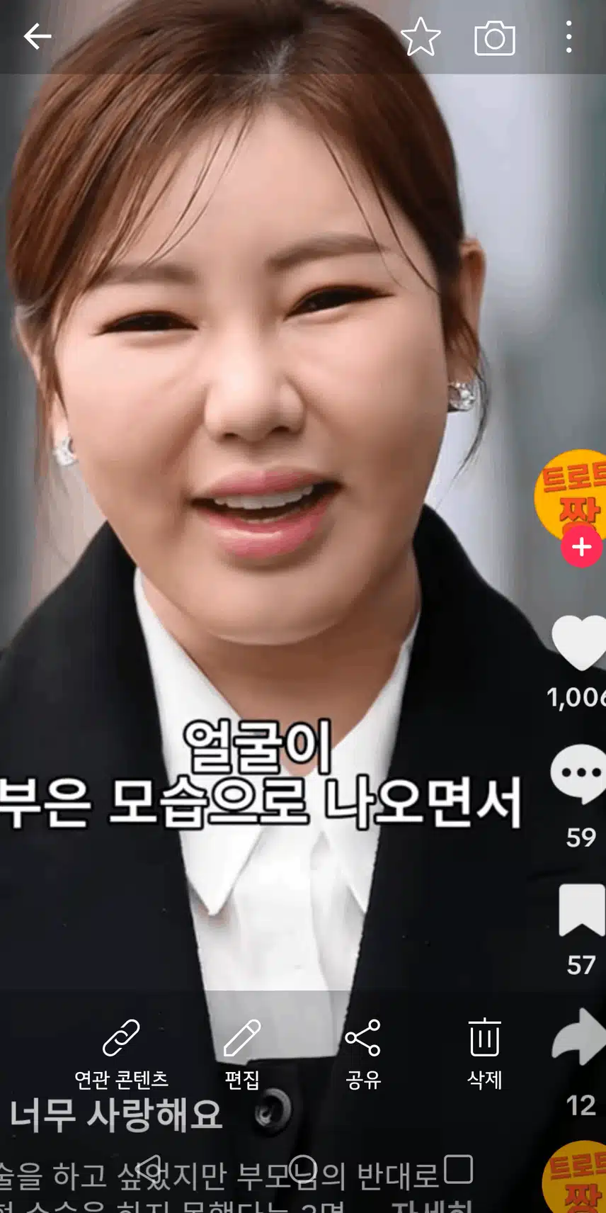 성형수술하고 싶었지만 부모님 반대로 못했대요