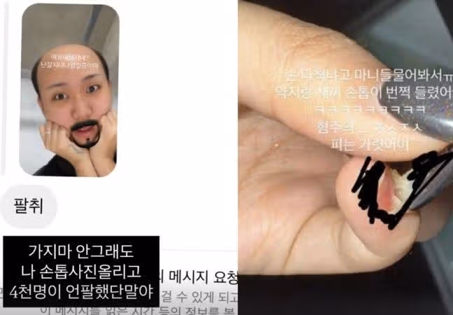 이영지 언팔 사태 총정리! 팬 4000명 떠난 이유는? 인스타 이탈 혐오 사진 논란