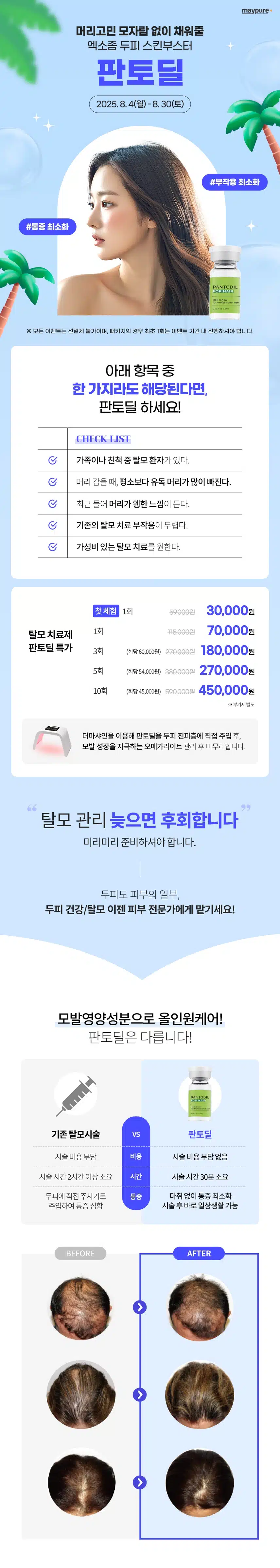 8월 이벤트 1ㅣ탈모 엑소좀 두피 스킨부스터 할인 이벤트 가격