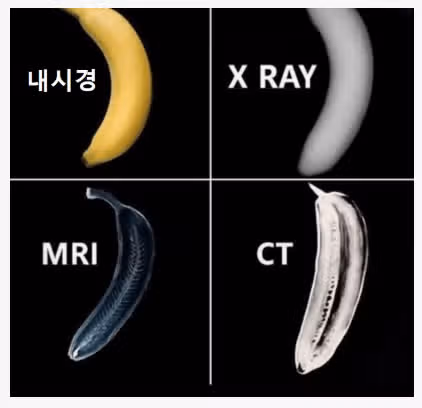 한눈에 보는 내시경, 엑스레이, CT, MRI의 차이