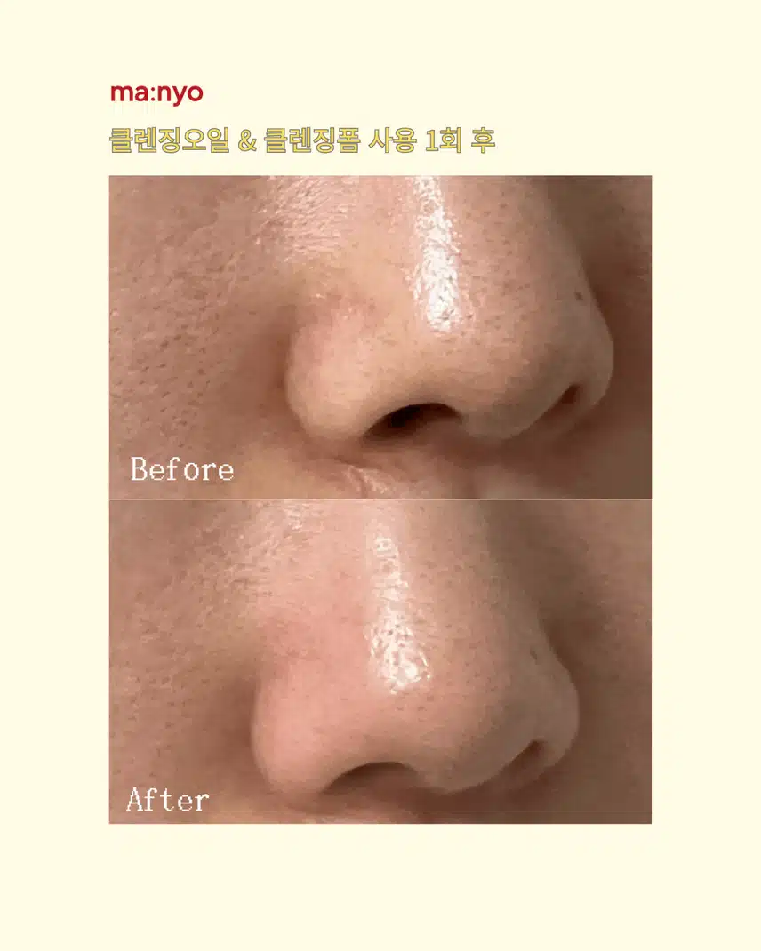 마녀공장 퓨어클렌징오일 내 피지박멸템 블랙헤드부자 추천