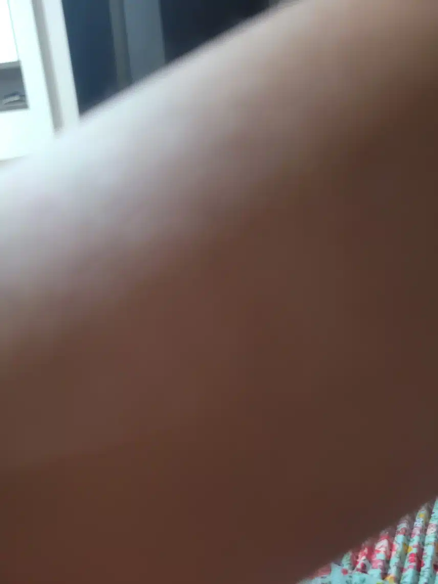 피부가 너무 까만데