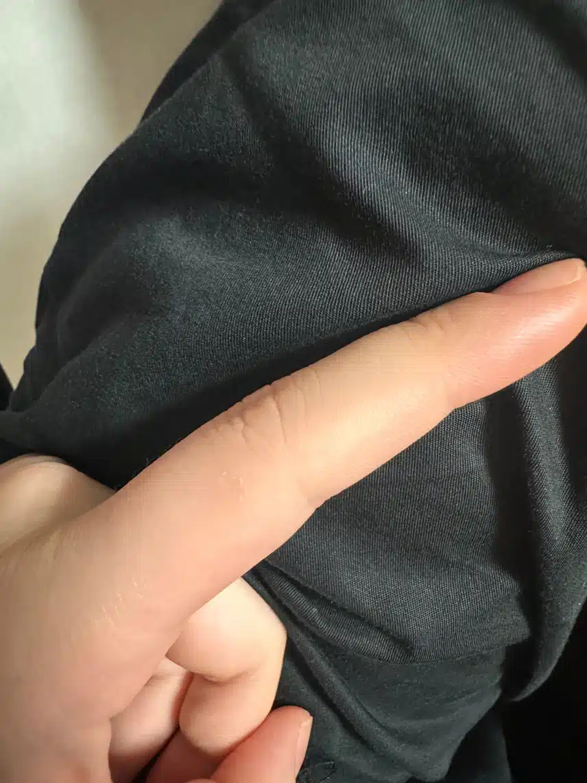 메이퓨어 구리점에서 인모드, 미간 보톡스, CO2 (점제거) 받은 리얼 후기