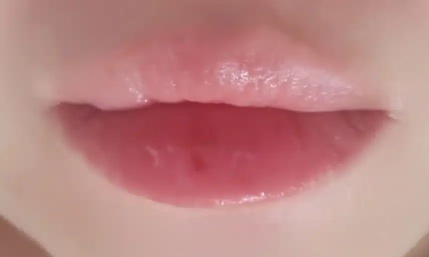 입술 포진 😭 뭘 발라야 될까요?