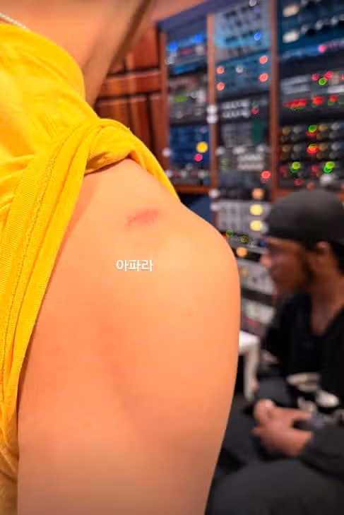 뷔 스토리에 올라온 안타까운 근황이네요