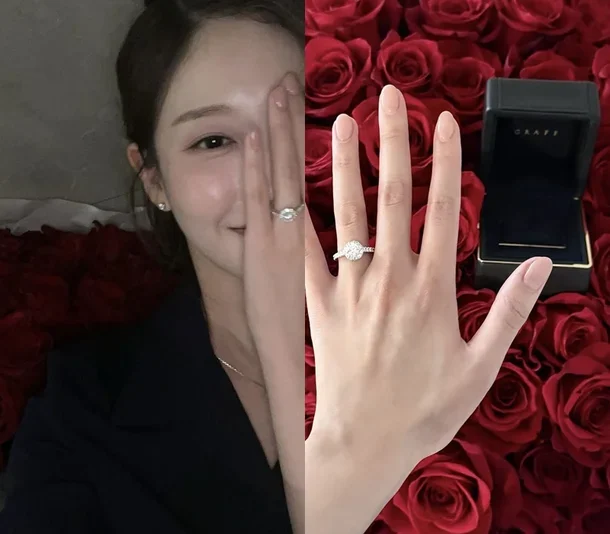 Người mẫu Ahn Sun-mi tiết lộ trực tiếp! Lời cầu hôn, chiều cao, tuổi tác, trường đại học và phẫu thuật thẩm mỹ của Lee Kyu-bin