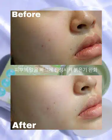 다가오는 여름☀️ 2023년에도 어김없이 나의 최애 공병템 등극 🌿브링그린 사철쑥 카밍 약산성 토너패드🌿 