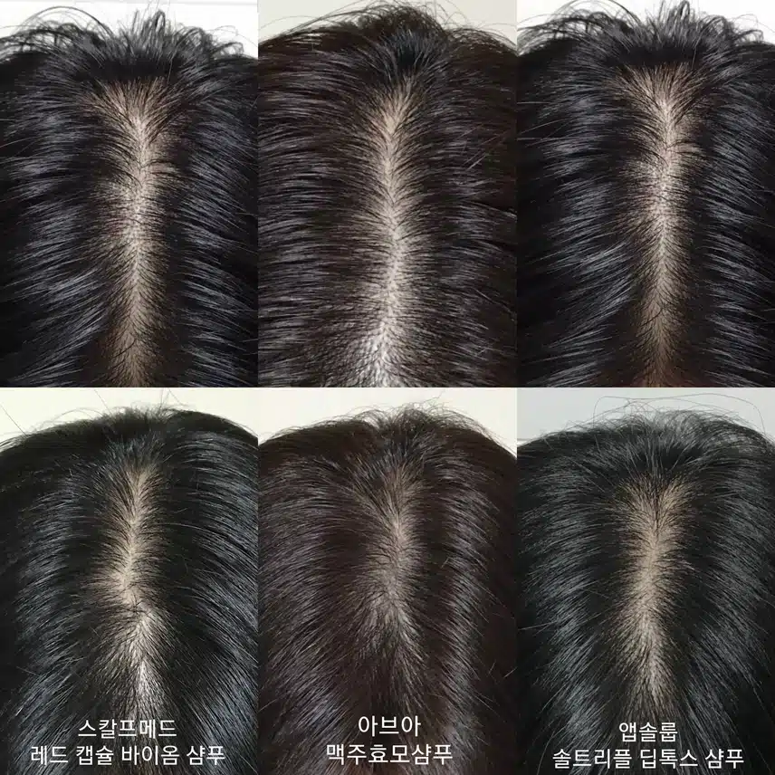 여름철 두피케어템 공유 [with my 공병템 딥클린 샴푸, 수분공급 두피세럼]